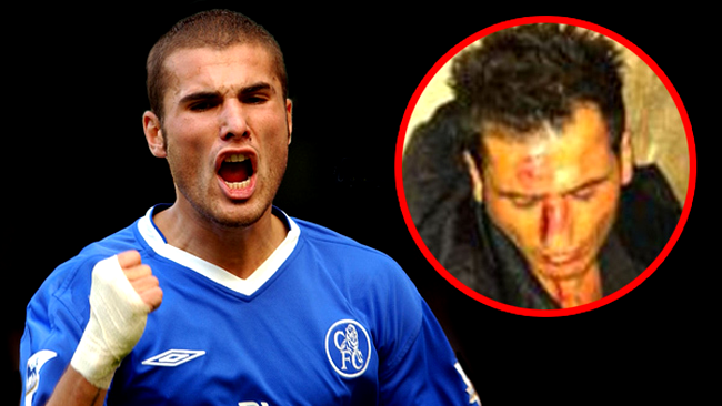 Asa arata chelnerul desfigurat de Mutu (Poze)