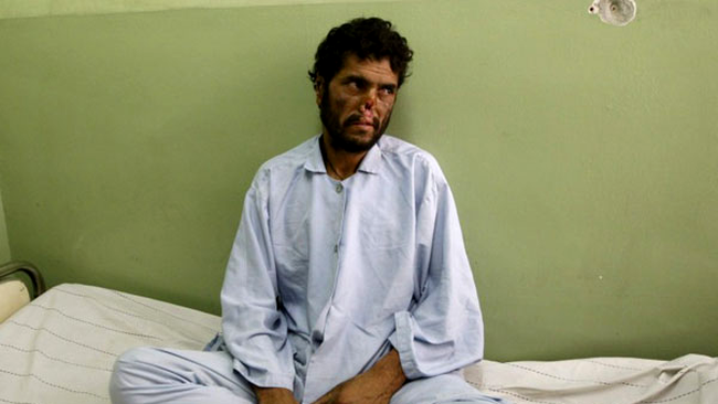 Mohammad a fost mutilat