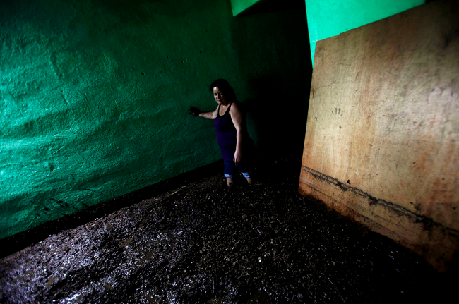 Femeie cu picioarele in cenusa si mal in Guatemala