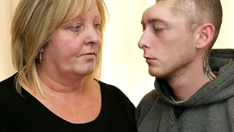 Un tanar a ramas cu jumatate de craniu, dupa o bataie