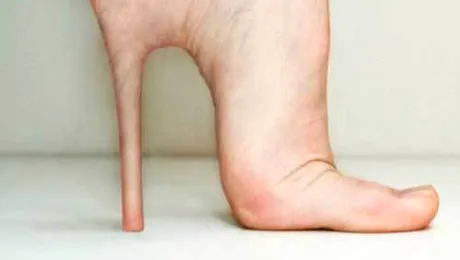 Implanturile de tocuri direct in calcai, cea mai traznita operatie