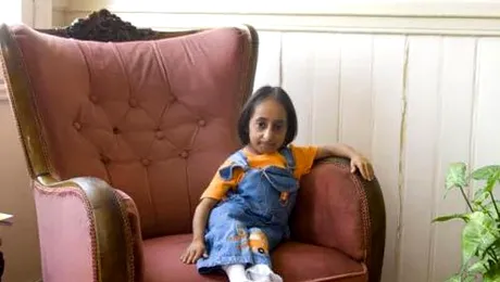 Hatice Kocaman, cea mai scunda femeie din lume