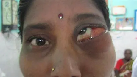 Ce a DESFIGURAT-O pe această femeie?