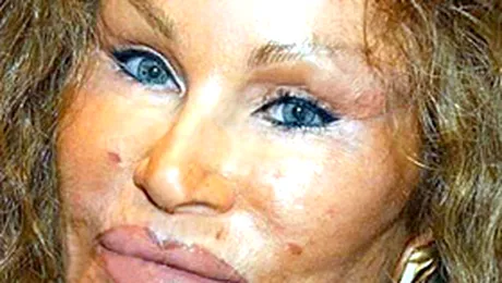 Topul celor mai urate vedete ale planetei (partea a II-a)