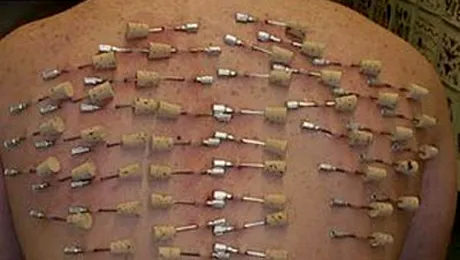 Un barbat si-a facut 1.197 de piercinguri, intr-o singura zi