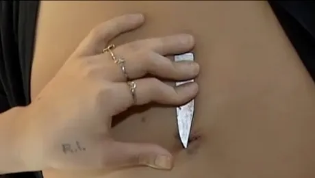 A trăit trei ani cu un cuțit înfipt în spate