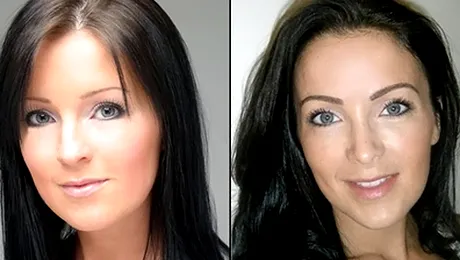 Și-a făcut transplant de sprâncene din cauza pensatului excesiv