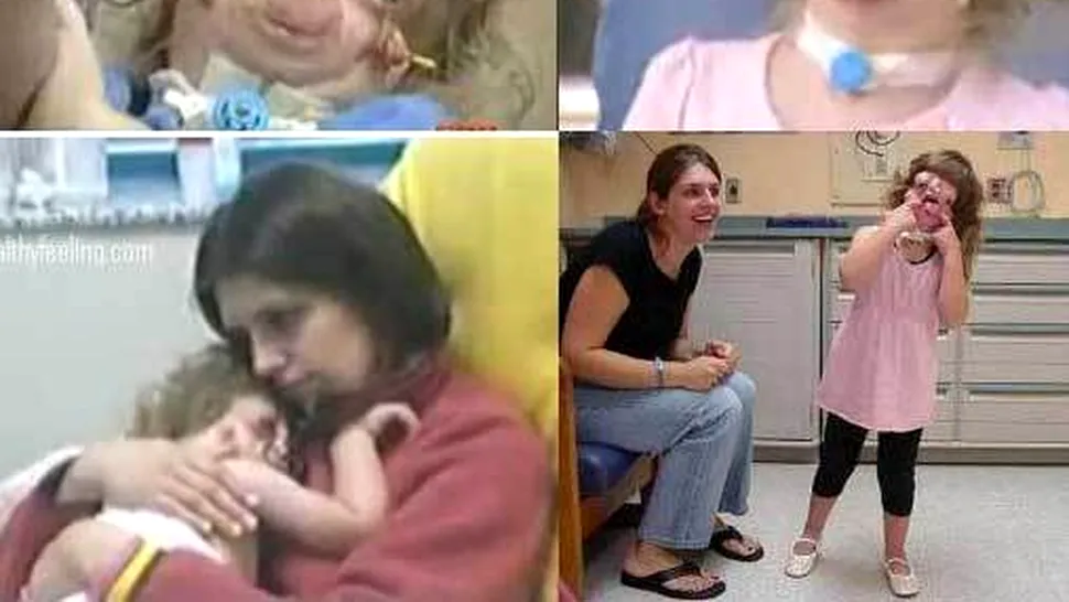 Imagini șocante cu fetița fără chip! (Video)