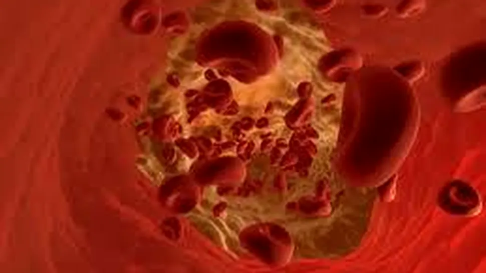 Ce este hemoglobina?