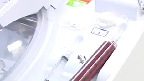 Spray cu celule stem: leacul minune impotriva arsurilor!