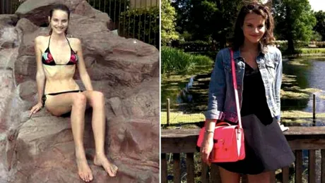 Dezvăluiri terifiante ale unui supermodel! ”Înlocuiam 3 mese cu 3 mere”