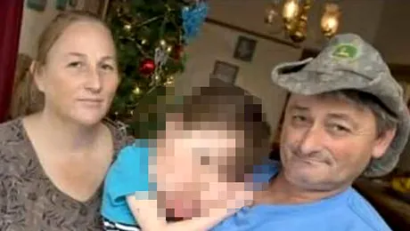 La patru ani, suferă de o boală rară care a desfigurat-o!