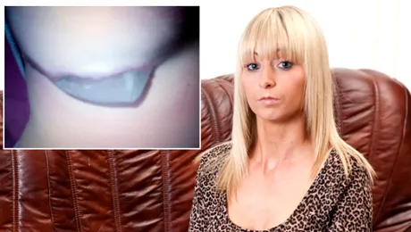 Ce i s-a întâmplat unei femei după o operație pentru mărirea bustului