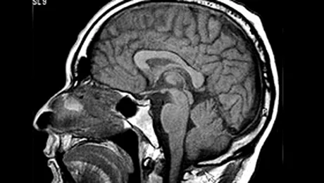 Cultura afecteaza modul de folosire al creierului