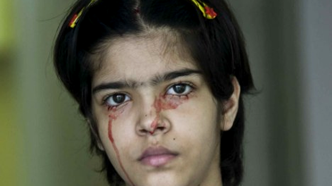 icuta Twinkle sufera de o boala bizara, prin care pierde sange prin tori porii