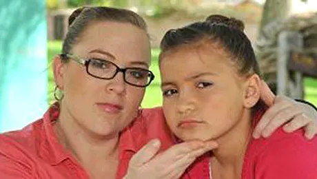 A pierdut custodia fetitei, dupa ce i-a injectat botox pentru a o infrumuseta