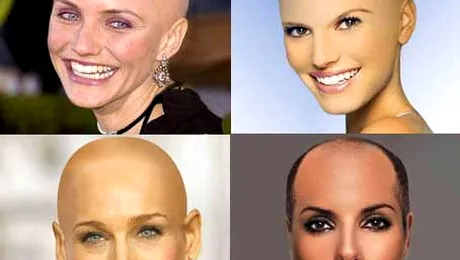 Vezi cum ar arata vedetele… fara par! (poze)