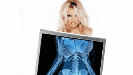 Sanii Pamelei Anderson sunt in pericol