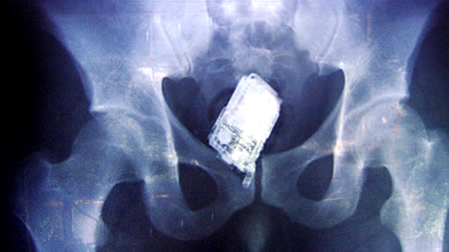 x ray