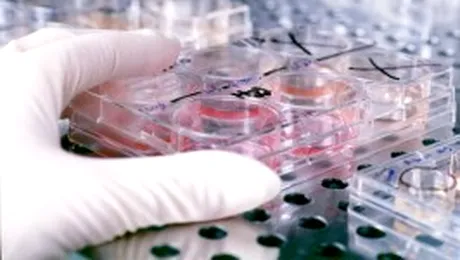 S-a descoperit o posibilă armă eficientă în lupta împotriva cancerului