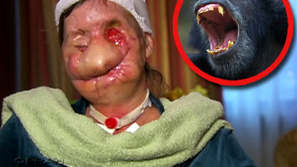 O femeie a fost atacata si desfigurata de un cimpanzeu (Video)