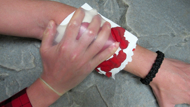 Mănușă chirurgicală făcută dintr-un prezervativ