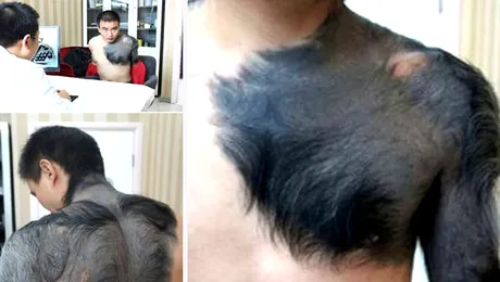 10 semne din naștere care au uimit lumea medicală!