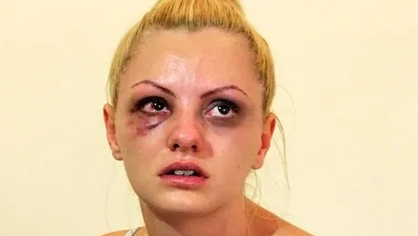 Alexandra Stan a ieșit din spital! A fost bătută pentru infidelitate?