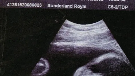 In Utero: Primul album înregistrat de un copil în pântecul mamei sale, „Sounds of the Unborn”