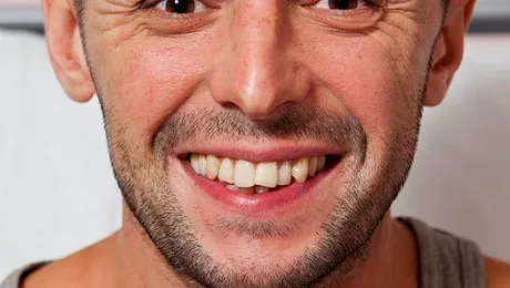 Omul ăsta a rămas fără o parte din craniu! (POZE)