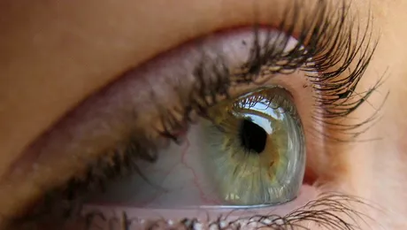 Din cauza bolii, nu vede decat 3 zile pe saptamana