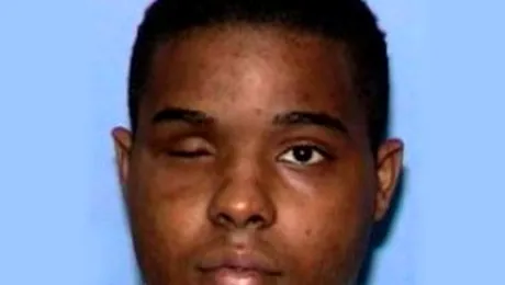 Si-a scos ochiul drept si l-a mancat, in public!