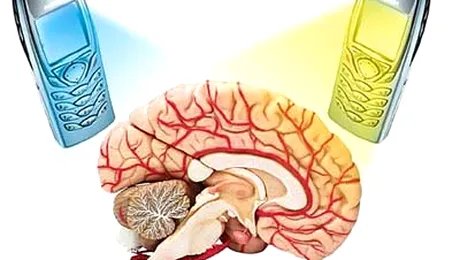 Ne afecteaza mobilul sanatatea? Raspunsul vine de la ICMET!