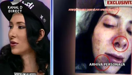 Violenţă de nedescris în showbiz-ul de la noi! Un cântăreţ cunoscut şi-a bătut crunt iubita: „M-a muşcat de faţă, mi-a smuls părul”