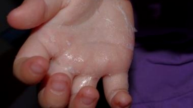 Să dezlipește adeziv uscat