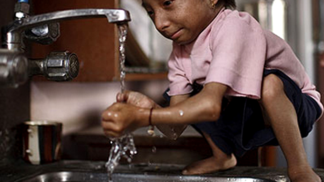 Khagendra, cel mai scund adolescent din lume