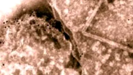 S-a descoperit bacteria care „naste” aur