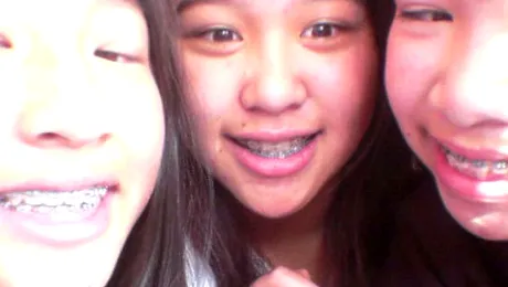 Ți-e rușine cu aparatul tău dentar? Asta te va va face să te răzgândești