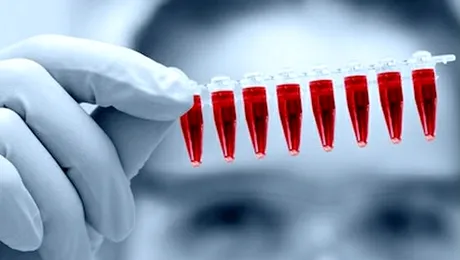 Cele mai periculoase 3 metale grele din sângele tău!