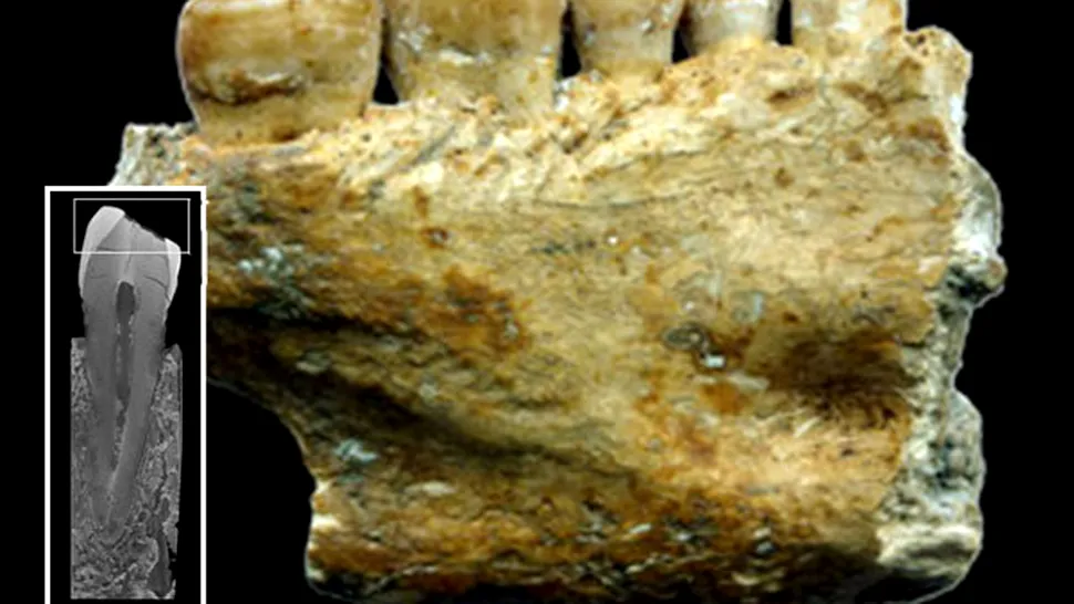 Când au apărut primii dentiști din Europa
