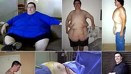A reusit sa slabeasca 200 de kilograme (Poze)