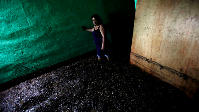 Femeie cu picioarele in cenusa si mal in Guatemala