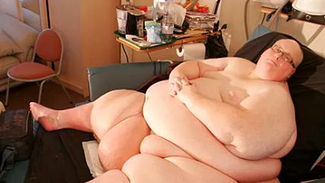 Cel mai gras om din lume a slăbit 300 de kilograme (Poze)