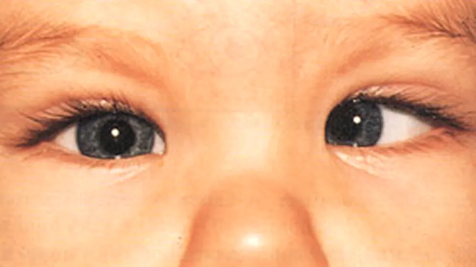 Sanatate din prima zi: Cu bebelusul la oftalmopediatru