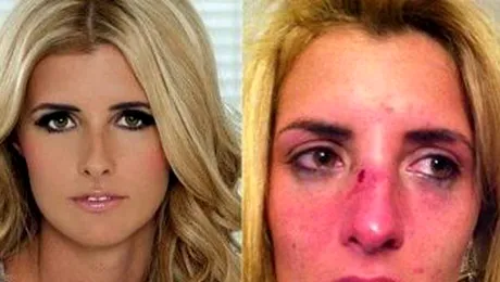 Prostituata lui Wayne Rooney, batuta si taiata pe fata