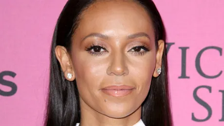 Mel B (ex-Spice Girls) va suporta un transplant de cornee
