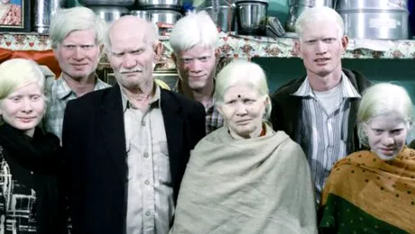 Cea mai numeroasă familie de albinoși din lume trăiește în India