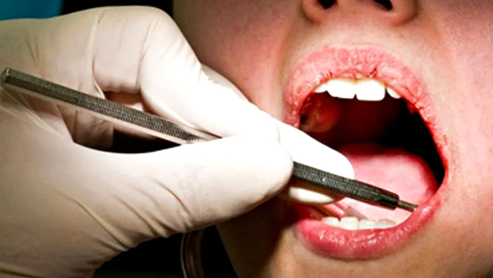 Regenerarea dinților, noua tehnică propusă de specialiști