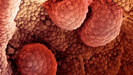 Ce cauzează cancerul?