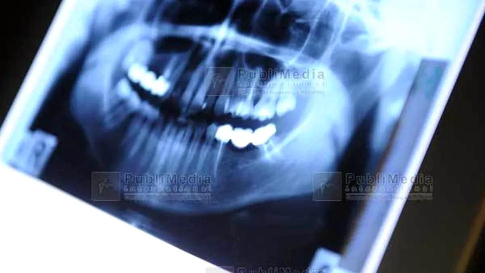 Specialiștii ne avertizează asupra efectelor radiografiilor dentare